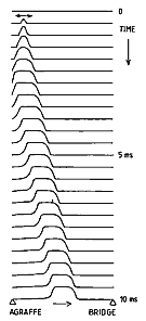 Fig. 2. The evolution of the propagating pulse on the string after hammer impact.